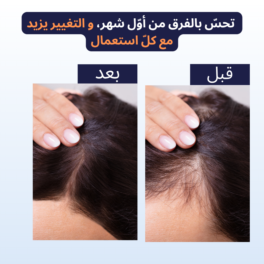 Dermastamp Medilax الأصلية - عناية ذكيّة لبشرتك وشعرك