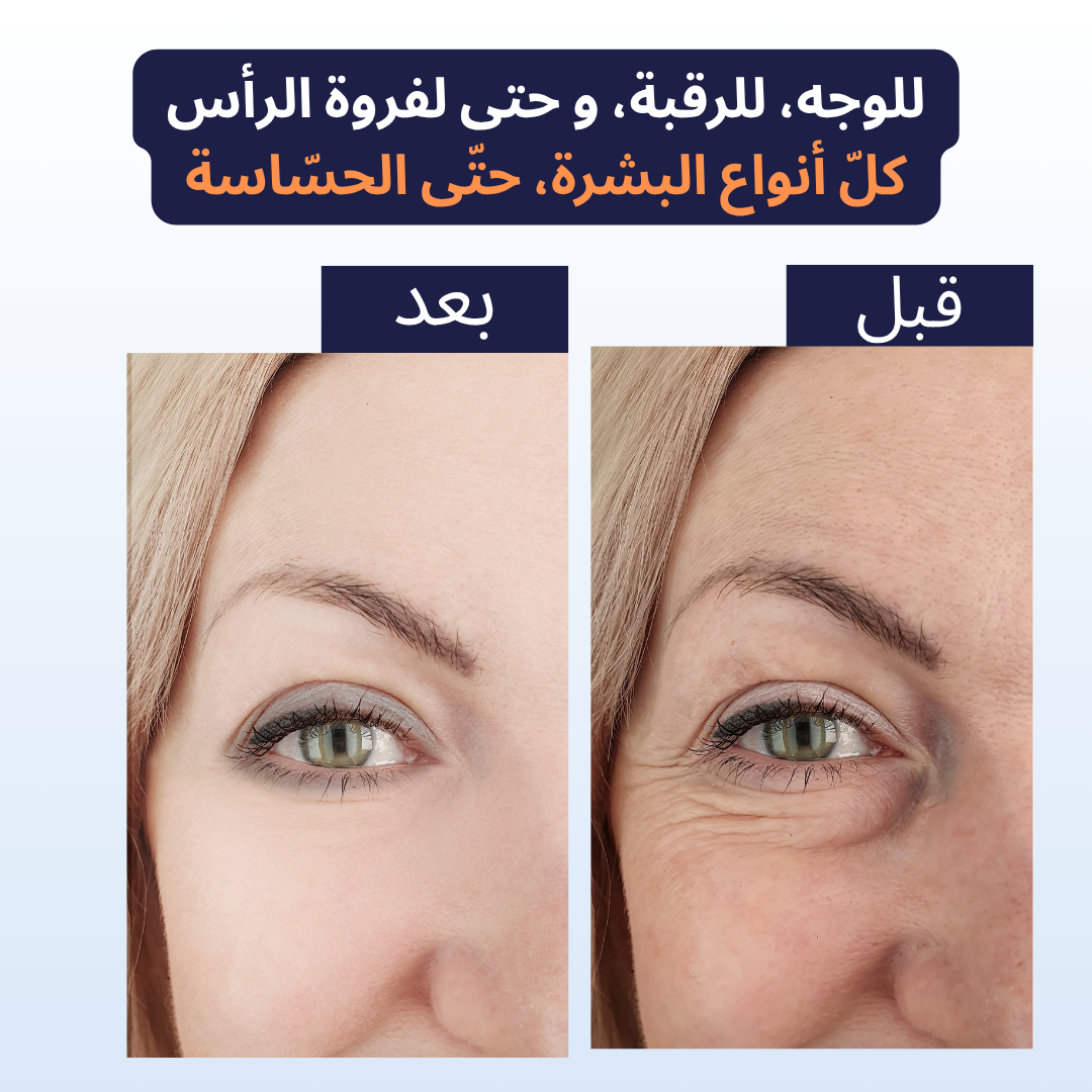 Dermastamp Medilax الأصلية - عناية ذكيّة لبشرتك وشعرك